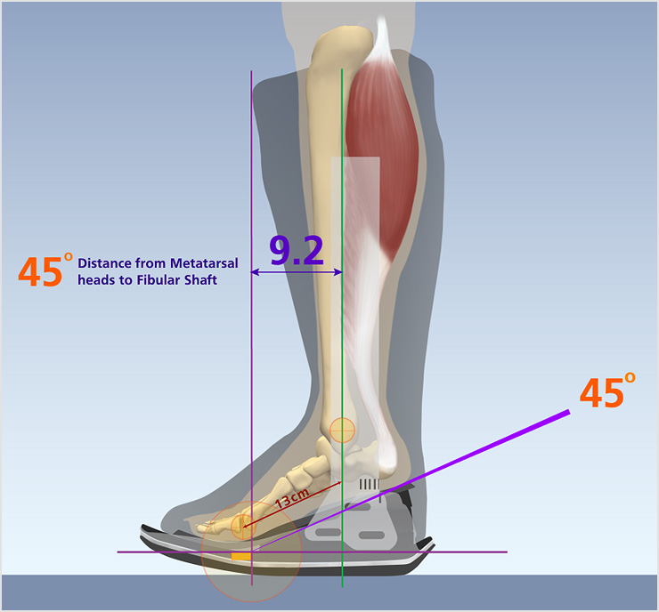 Orthopedic Boot Illustration