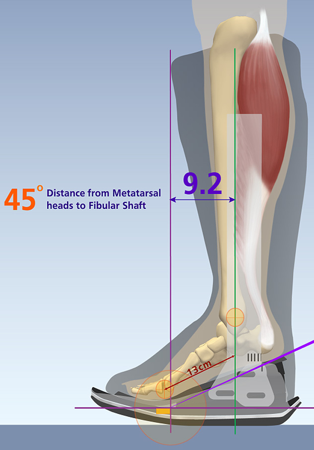Metatarsal Illustration