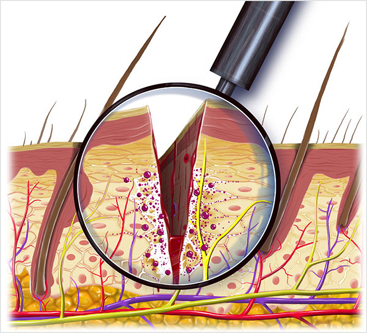 Pain Treatment Illustration