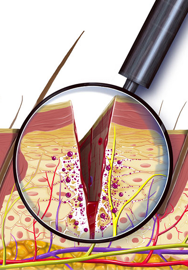 Pain Treatment Illustration