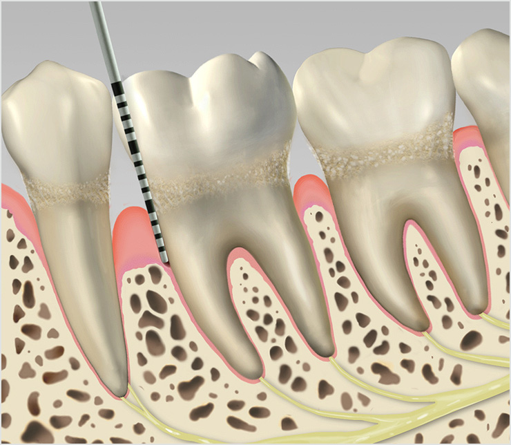 Dental Illustration