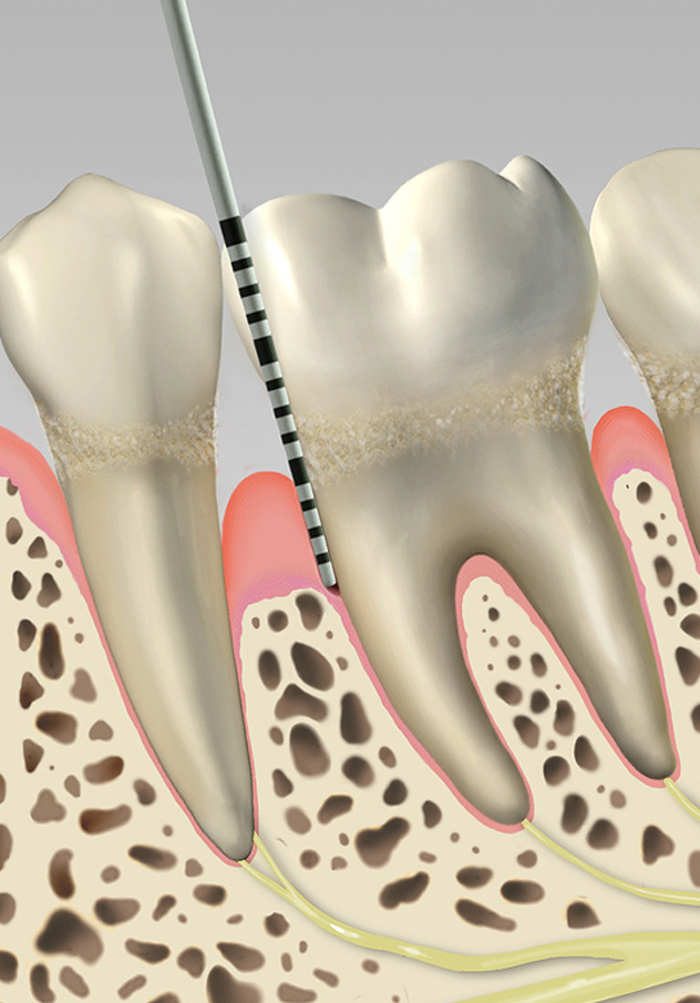 Dental Biomedical Illustration